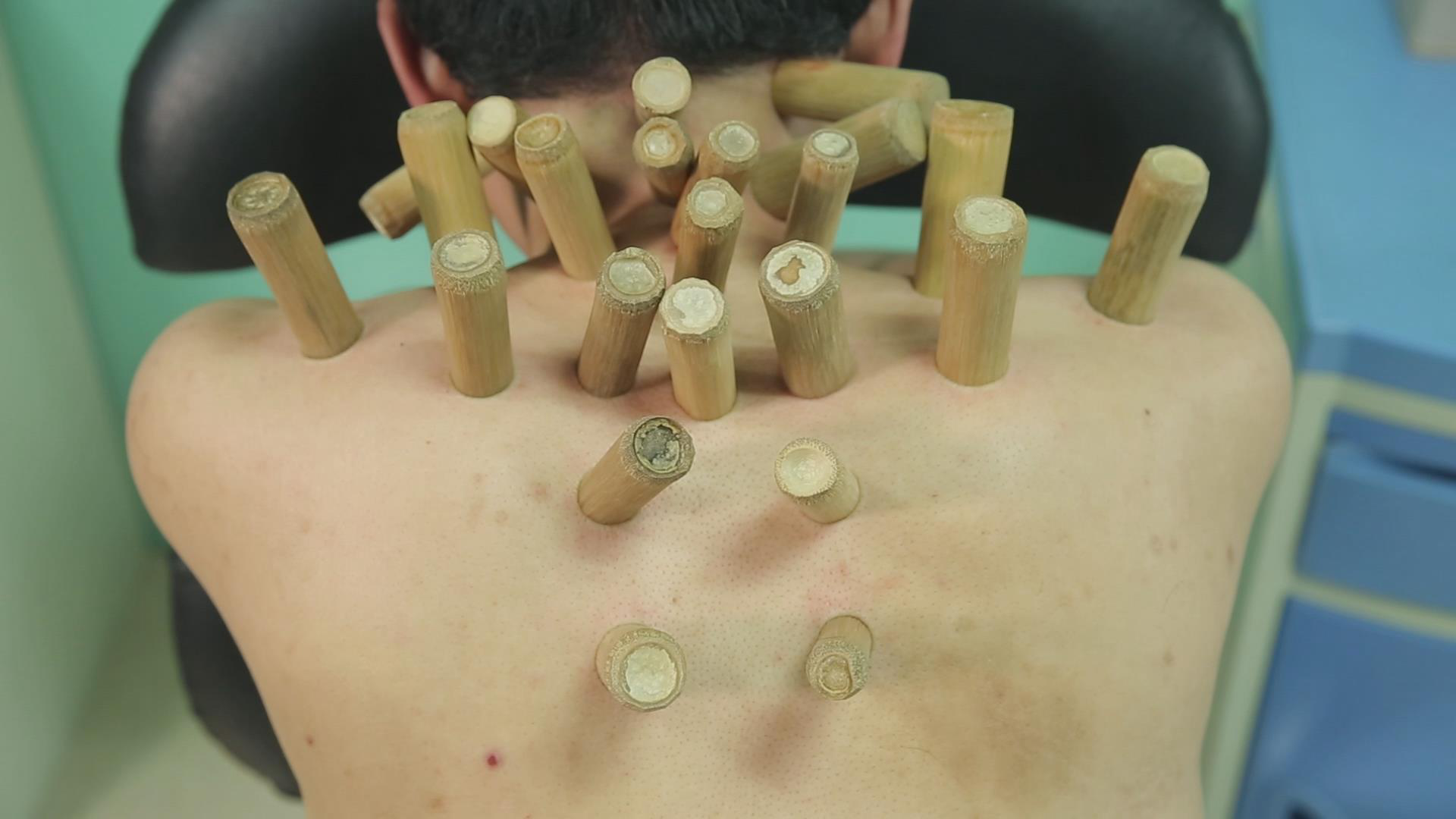 国葆堂:传承400多年的宫廷脊椎疗法